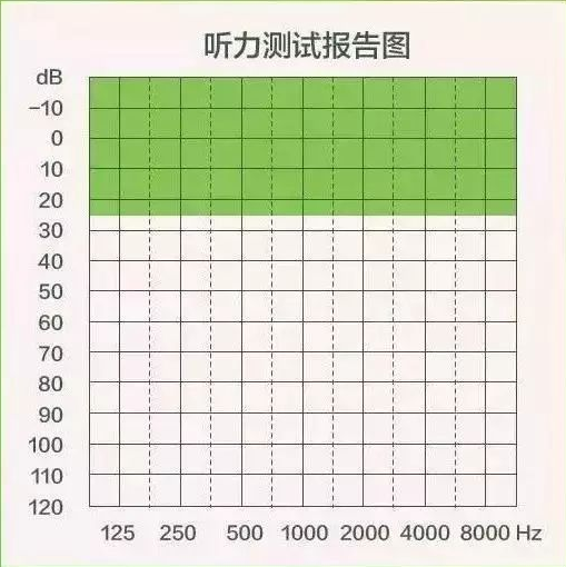 【聽(tīng)力科普】三分鐘看懂純音聽(tīng)力圖(圖1)