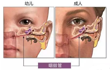 【聽(tīng)力科普】?jì)和?tīng)力保健小知識(圖3)