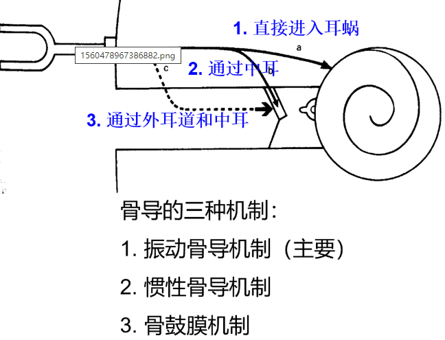 【聽(tīng)力科普】堵耳效應——堵住聲音的退路(圖4)